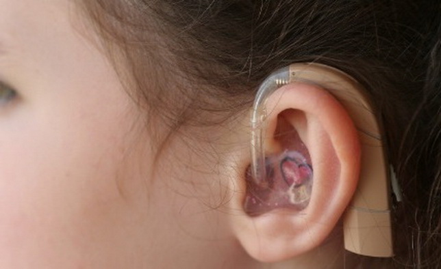 Как работают слуховые аппараты
